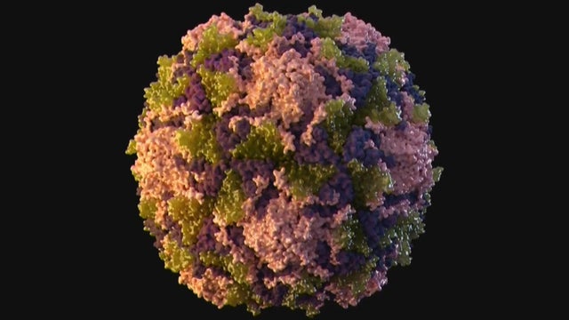 polio.jpg 